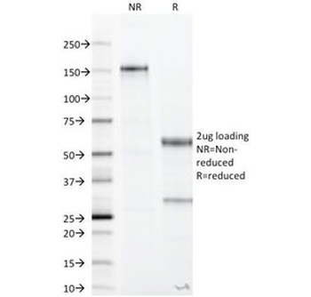 Recombinant CA19-9 Antibody [CA19.9/1390R]