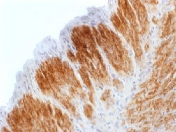 CNN1 Antibody