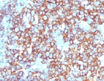 MS4A1 Antibody