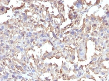 Recombinant TNF-alpha Antibody [RMTNFA-1]