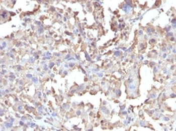 TNF Antibody