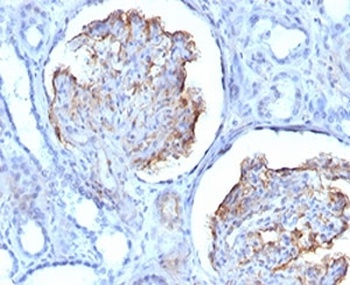 WT1 Antibody