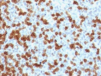 PDCD1 Antibody