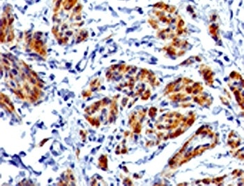 CALD1 Antibody