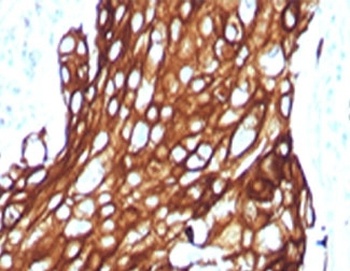 K77 Antibody