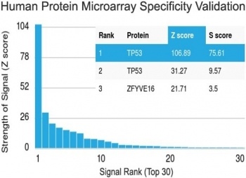 Recombinant p53 Antibody [TP53/1799R]
