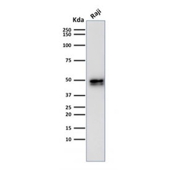 Recombinant CD79a Antibody [IGA/1790R]