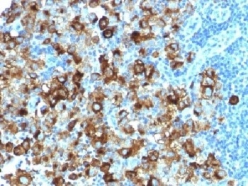 PMEL Antibody