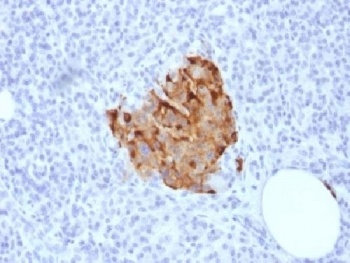 Recombinant Chromogranin A Antibody [CHGA/1773R]