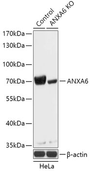 ANXA6 Antibody, KO Validated