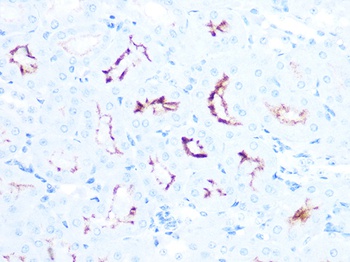 ACE2 Antibody, Monoclonal