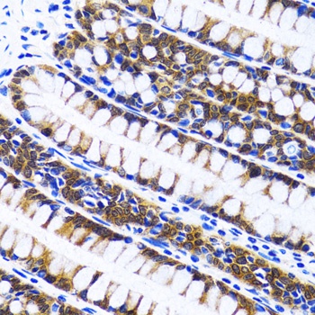 Fatty Acid Synthase Antibody, KO Validated