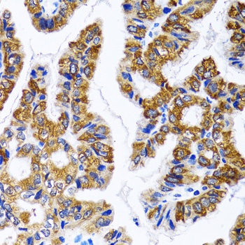 Fatty Acid Synthase Antibody, KO Validated