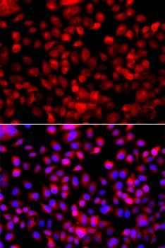 Fatty Acid Synthase Antibody, KO Validated