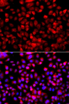 FASN Antibody