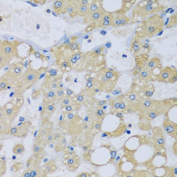 NDUFA7 Antibody, KO Validated