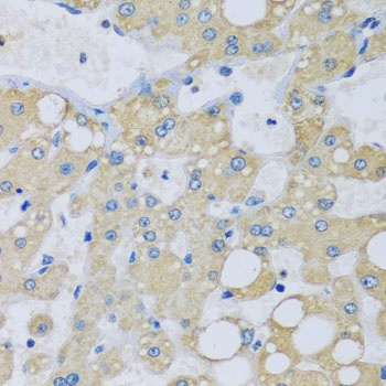 NDUFA7 Antibody