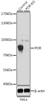 POR Antibody, KO Validated