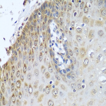POR Antibody, KO Validated