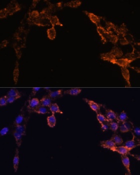 POR Antibody, KO Validated