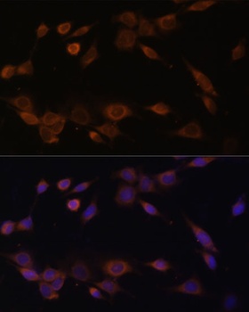 POR Antibody, KO Validated