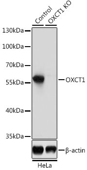 OXCT1 Antibody, KO Validated