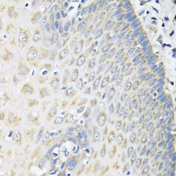 OXCT1 Antibody, KO Validated