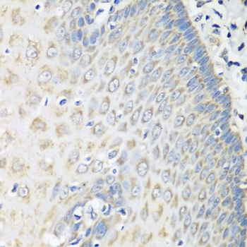 OXCT1 Antibody