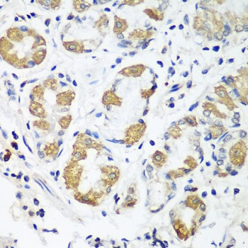 OXCT1 Antibody, KO Validated