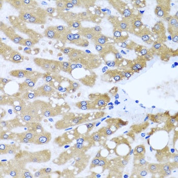 NDUFS3 Antibody, KO Validated