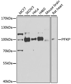 PFKP Antibody