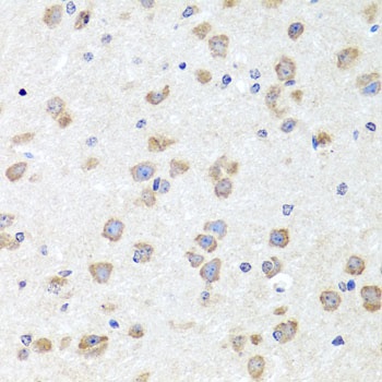 CHD1 Antibody, KO Validated