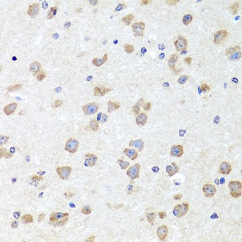 CHD1 Antibody