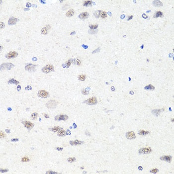CHD1 Antibody, KO Validated