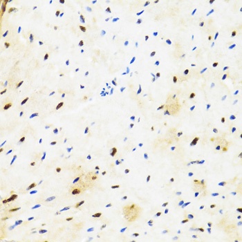 SUZ12 Antibody