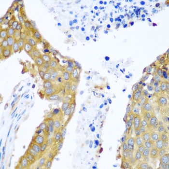 YBX1 Antibody, KO Validated