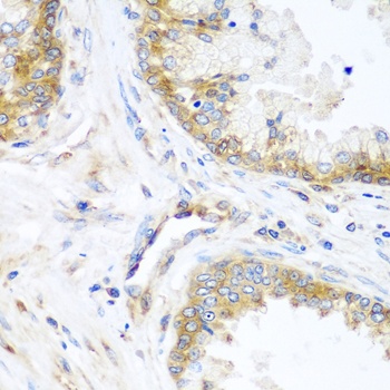 YBX1 Antibody, KO Validated