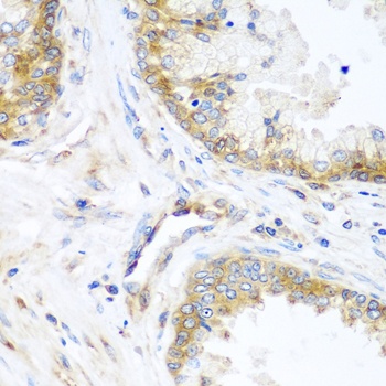 YBX1 Antibody