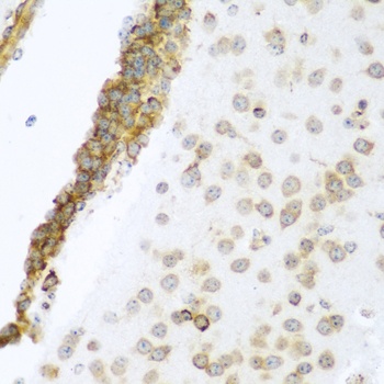 YBX1 Antibody, KO Validated