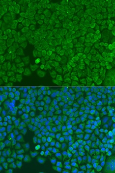 YBX1 Antibody, KO Validated