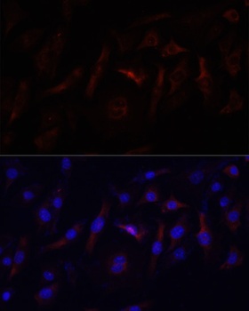 YBX1 Antibody, KO Validated