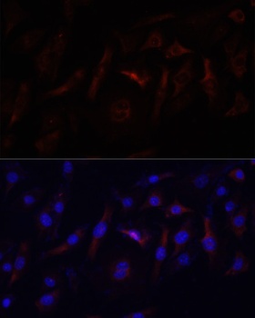 YBX1 Antibody