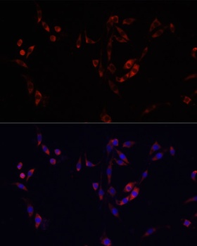 YBX1 Antibody, KO Validated
