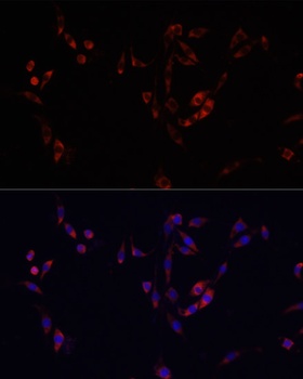 YBX1 Antibody