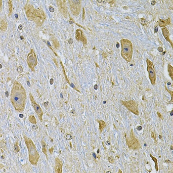 ITGA2 Antibody, KO Validated