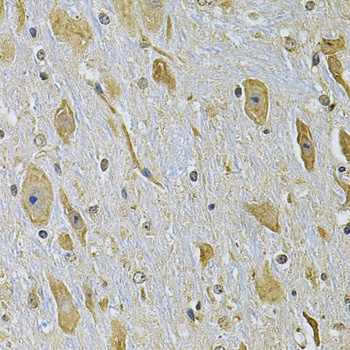 ITGA2 Antibody