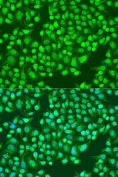 ITGA2 Antibody