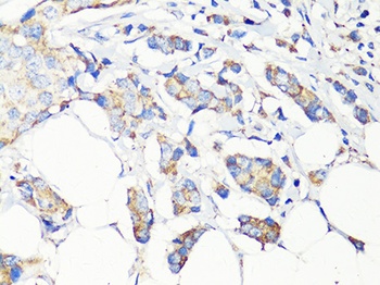 Beclin 1 Antibody, KO Validated