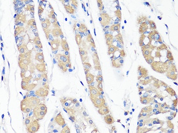 Beclin 1 Antibody, KO Validated