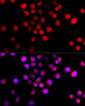 Beclin 1 Antibody, KO Validated